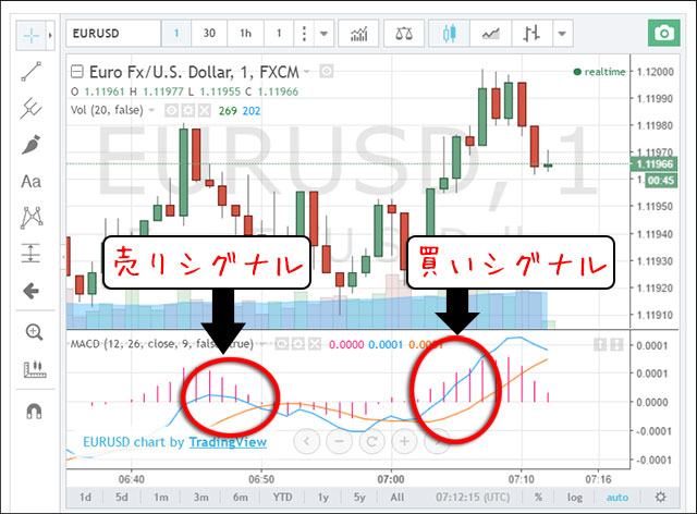 MACD